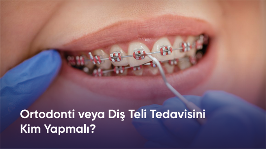 ortodonti-tedaviyi-kimler-yapmali